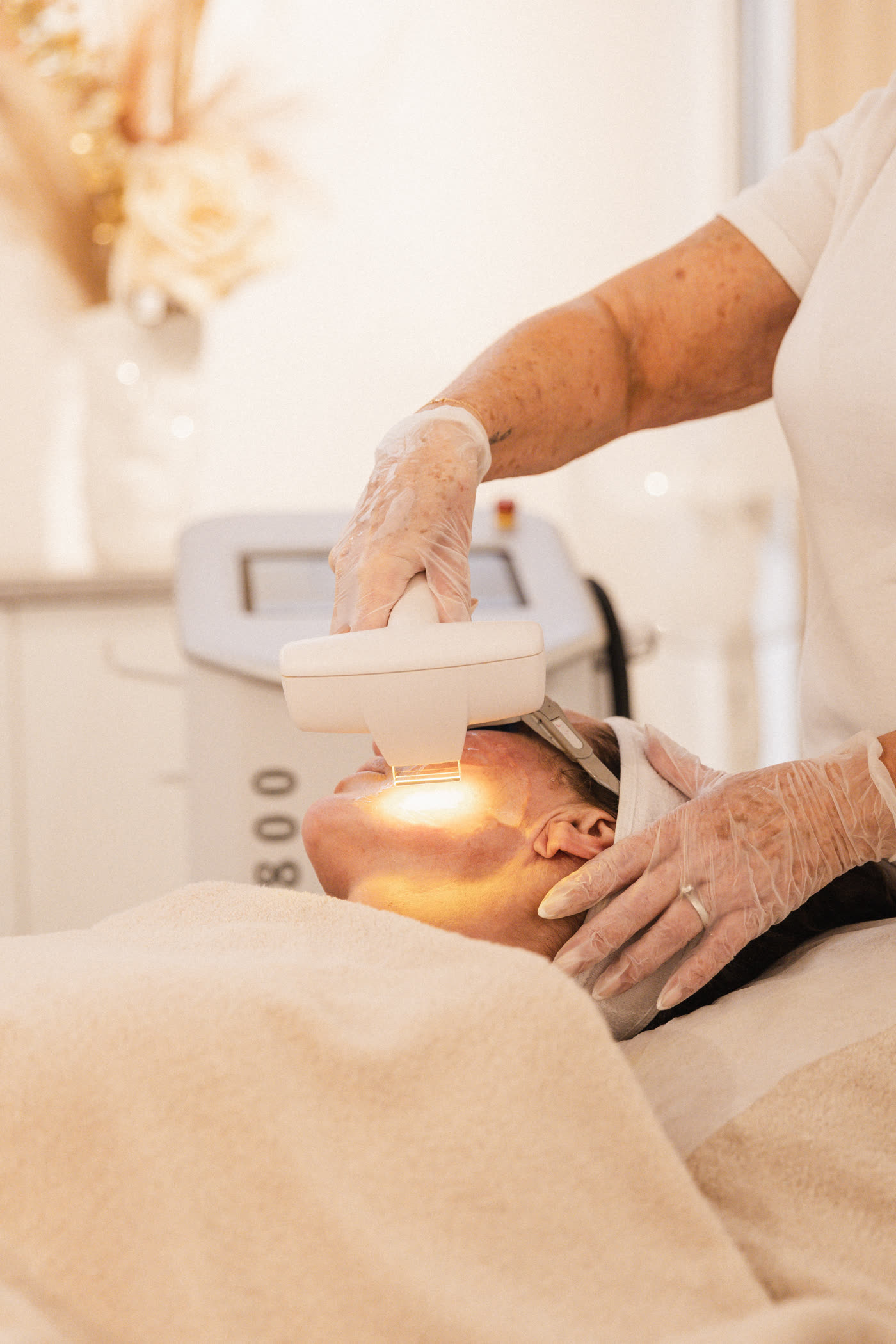 IPL Skin Rejuvenation-behandling på HBC i Borås
